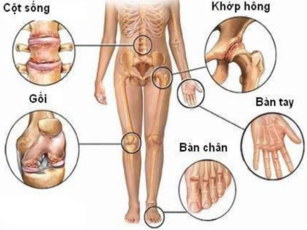 Vì sao khớp bị khô?